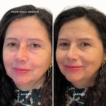 Pack teint parfait - peau medium